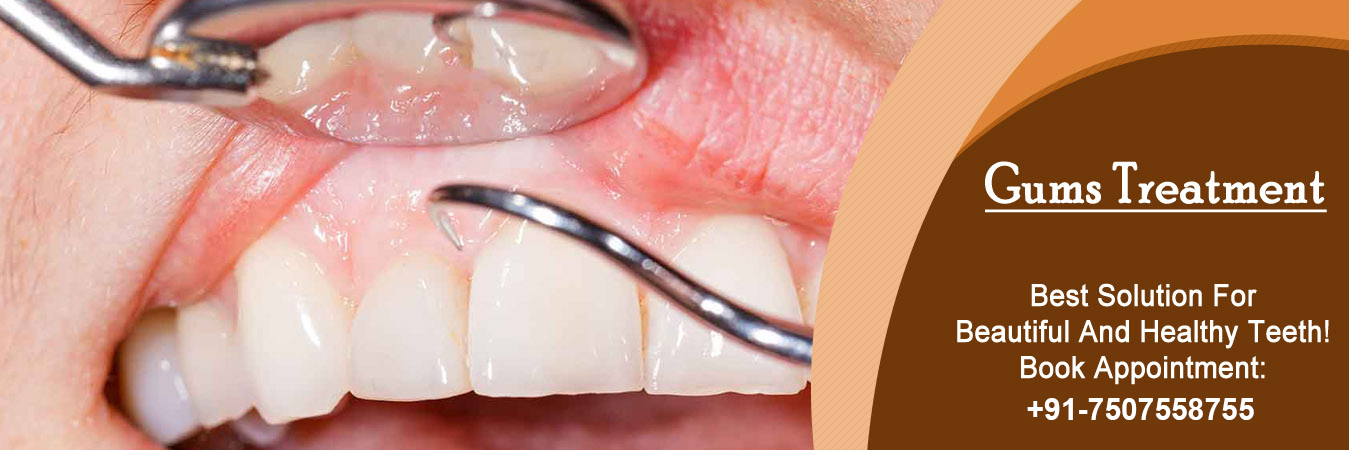 Gum Surgery Treatment in Pimpri Chinchwad Pune